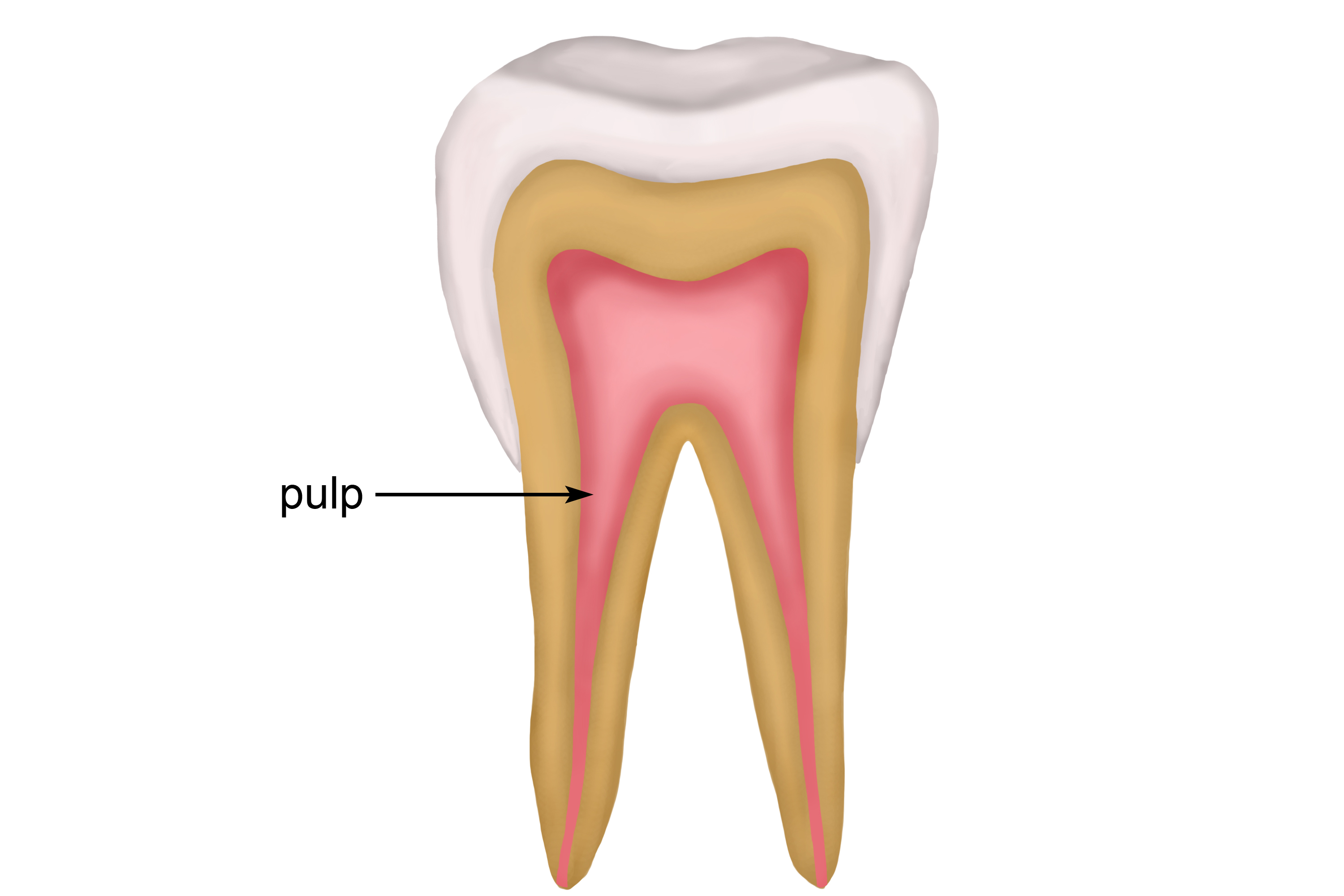Pulp is a living tissue inside the dentine that is connected to the blood stream and nerves